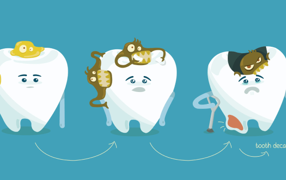 پیشگیری از پوسیدگی دندان: گام هایی برای داشتن دندان هایی سالم
